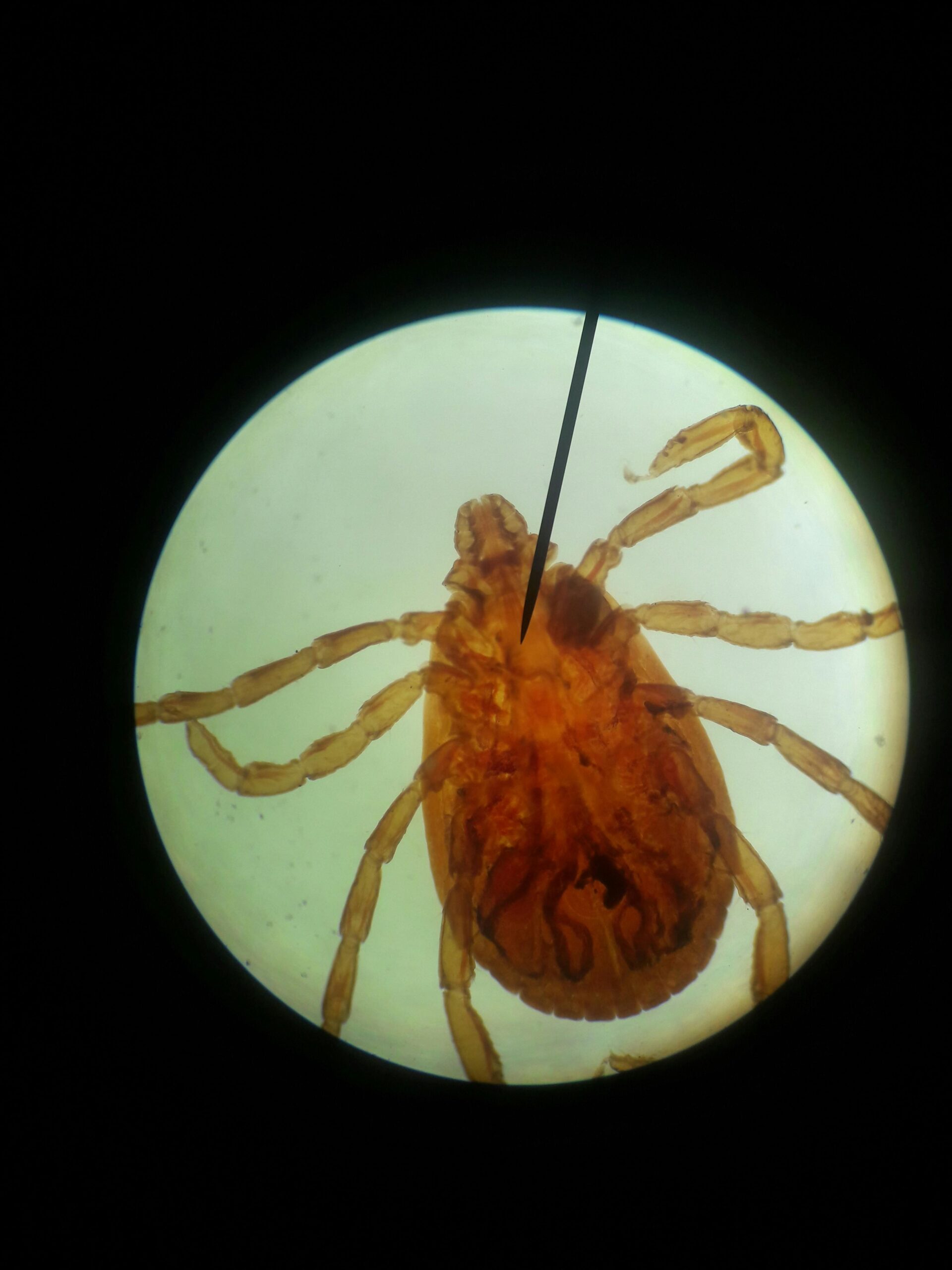 2026 Is Shaping Up to Be One of the Worst Tick Seasons Ever. Here’s What You Need to Know